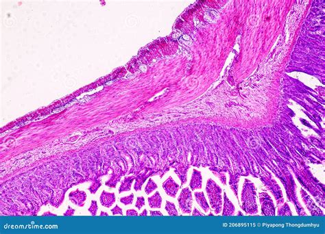 Histological Sample of Human Under the Microscope. Stock Image - Image ...