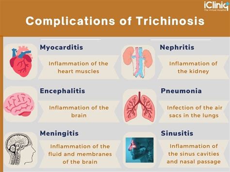 What Is Trichinosis?