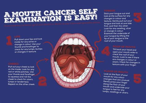 mouth_cancer - Will Murphy Dentistry