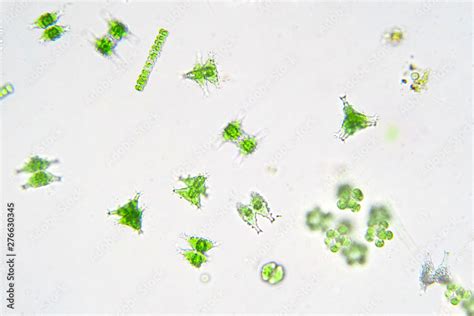 Freshwater aquatic plankton under microscope view. Stock Photo | Adobe ...