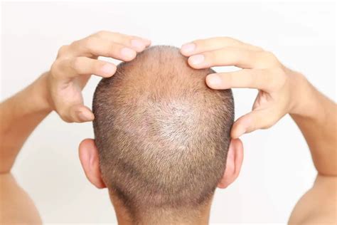 12 [Best] Bald Head Moisturizers & Lotions | Expert Care - Bald & Beards