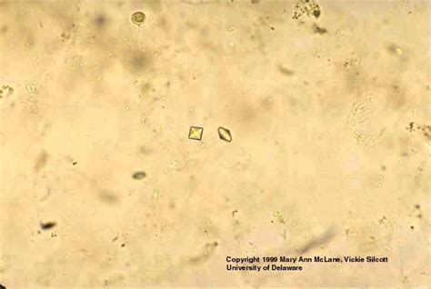 Calcium oxalate crystals | Medical Laboratories