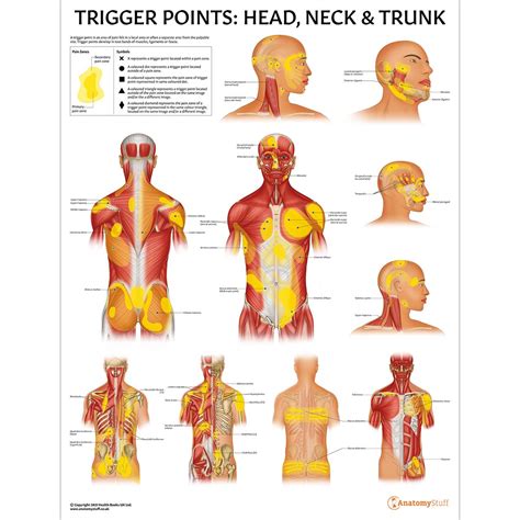 Trigger Points: Head, Neck & Trunk | Myofascial Pain Charts