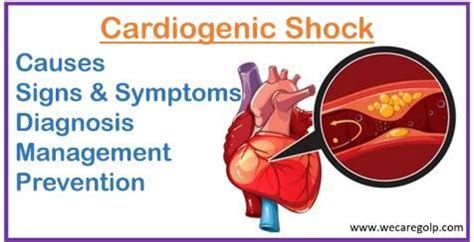 Cardiogenic Shock (CS): Causes, Symptoms, Management - We Care