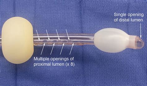 Esophageal tracheal airway/ Combitube® | Anesthesia Airway Management (AAM)