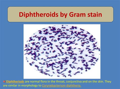 PPT - Corynebacterium diphtheriae PowerPoint Presentation, free download - ID:3672369