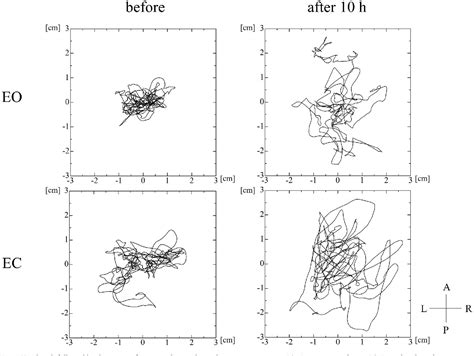 Figure 1 from Changes in postural sway during upright stance after ...