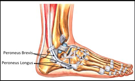 Peroneal tendon tears of the ankle: Orthopedic Center for Sports Medicine: Sports Medicine ...