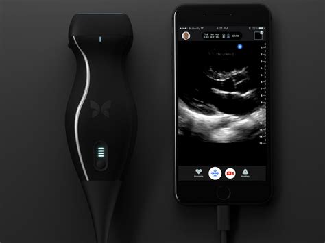 Butterfly IQ - Ultrasound Anywhere, Anytime - Electronics-Lab.com