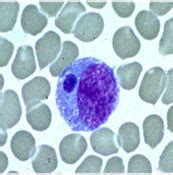 Ehrlichia - Microbiology - Medbullets Step 1