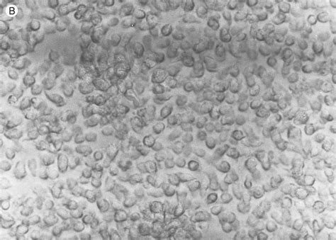 Syncytia formation in a herpes virus saimiri (HVS)-transformed T-cell ...