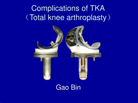 PPT - Complications of TKA （Total knee arthroplasty） PowerPoint Presentation - ID:6852470