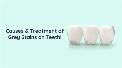 Causes and treatment for gray stains on teeth