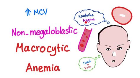 Non-megaloblastic Macrocytic Anemia - YouTube