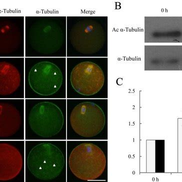 Acetylated α-tubulin (Ac α-tubulin) and α-tubulin were increased in ...