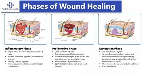 Granulation Tissue Wound Healing Stages - vrogue.co