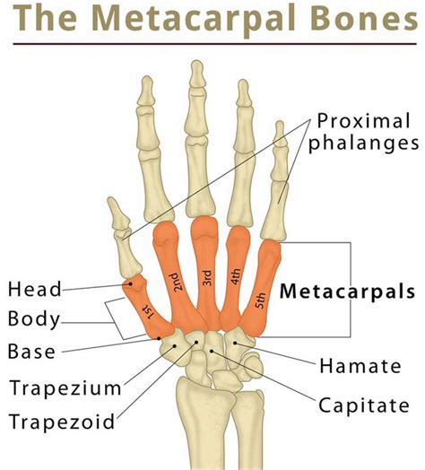 Metacarpal fracture causes, symptoms, diagnosis & treatment