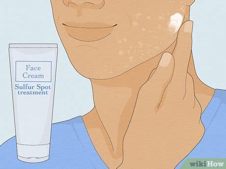 How to Get Rid of White Spots on the Skin Due to Sun Poisoning