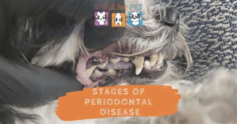 Stages of Periodontal Disease - Oral Health