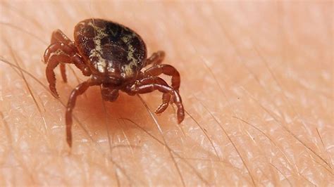 Colorado Tick Fever: Symptoms, Complications & Diagnosis