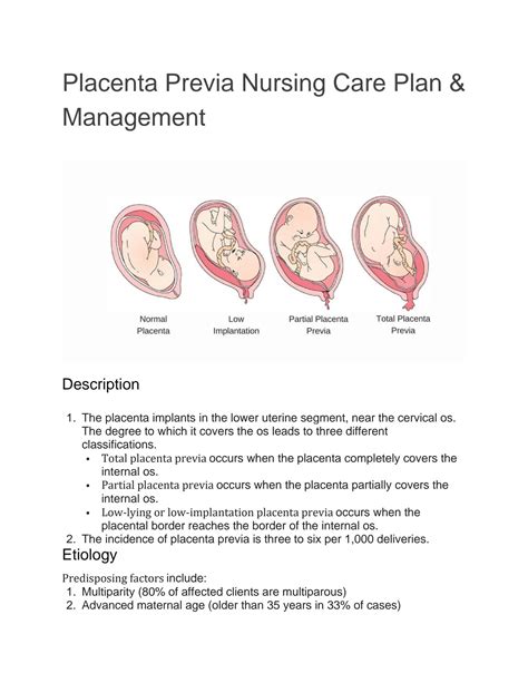 Placenta Previa Nursing Care Plan And Management | Porn Sex Picture