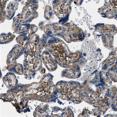 Fibrillin 1 Antibody (PA5-82598)