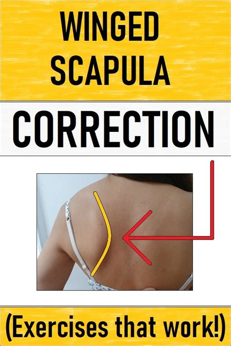 Winged Scapula correction exercises in 2021 | Winged scapula, Winged ...