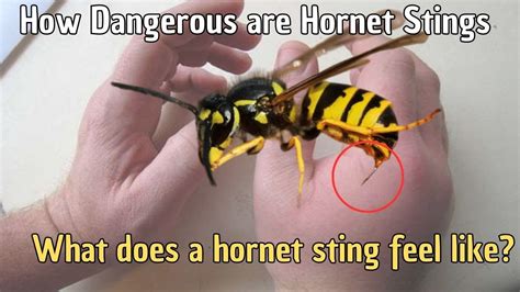 How Dangerous are Hornet Stings? 🐝 What does a hornet sting feel like ...