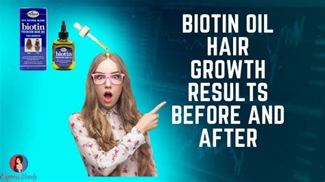 😍Biotin oil for hair growth | Before vs After | Is Biotin Good for Hair Growth?💇‍♂️ - YouTube