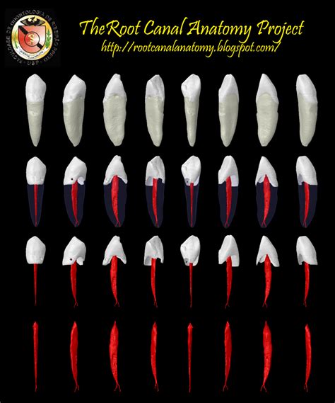 The Root Canal Anatomy Project: Mandibular Canine