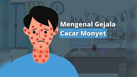 Mengenal Gejala Cacar Monyet - Serambinews.com