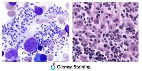 Giemsa Stain | Composition, Principle, Procedure & Uses