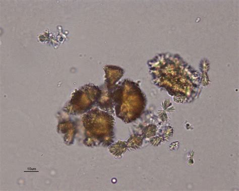 Urine crystals | eClinpath