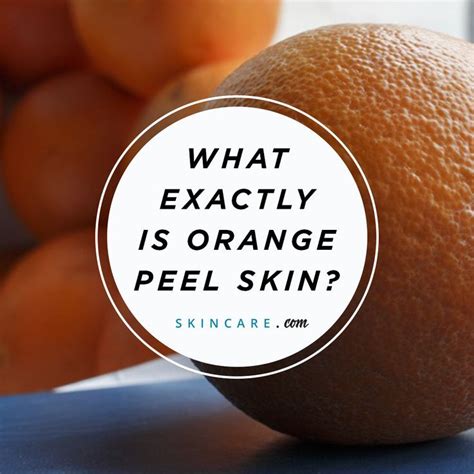 Orange Peel Texture Skin: How To Improve The Appearance Of Your Skin | Heidi Salon