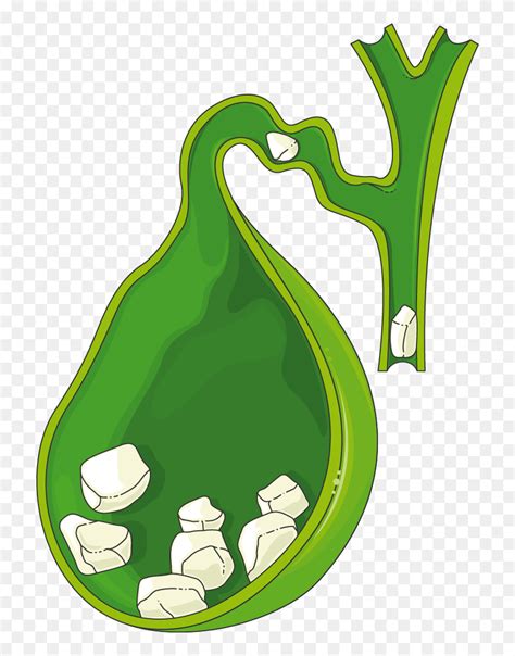 Download Gallbladder Clipart - Png Download (#5657296) - PinClipart