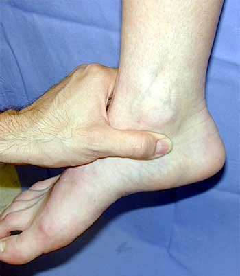 Inner Ankle Pain Causes and Best Treatment