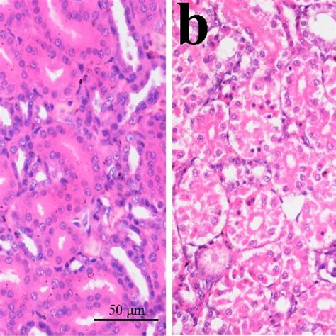 Morphological changes of apoptotic cells. (a) In the apoptotic cell,... | Download Scientific ...