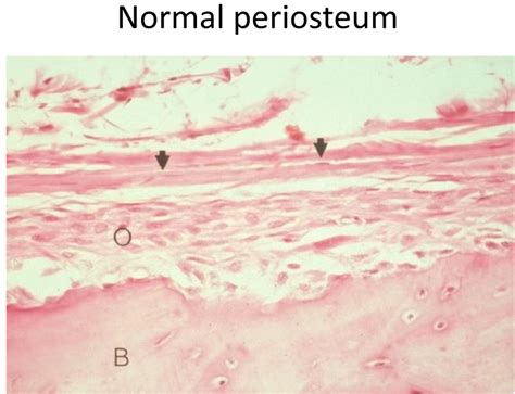 Normal Periosteum Diagram | Quizlet