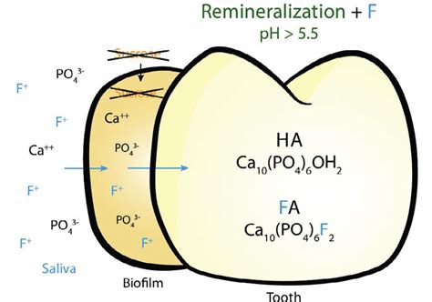 The Delicate Balance of Remineralization and Demineralization - Decisions in Dentistry