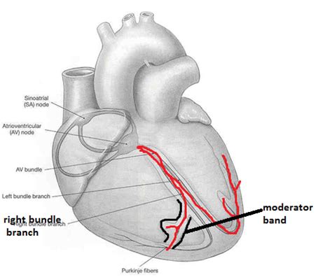 easyhumanatomy: Moderator band / septomarginal trabeculum