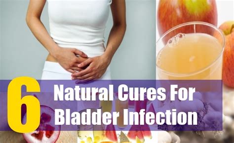 6 Best Natural Cures For Bladder Infection – Natural Home Remedies & Supplements