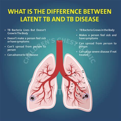 Latent Tuberculosis or Tuberculosis disease: What is the difference? - Dr. Ankit Parakh