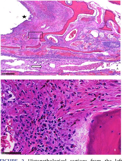 Figure 4 from ABERRANT MIGRATION OF CUTEREBRA LARVAE IN 2 DOMESTIC RABBITS (ORYCTOLAGUS ...