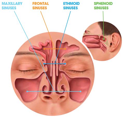 Everything You Need to Know About Sinusitis: Part 1 - Sinus Relief Center