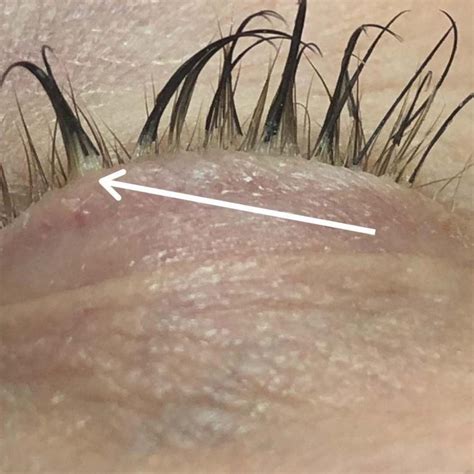 Can You Get Lash Mites on Lash Extensions + What to Do