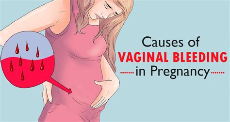 Vaginal Bleeding and Spotting during Pregnancy: What it means