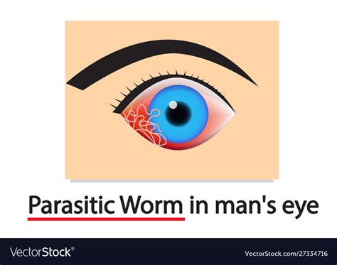 Closeup parasitic worms in humans eye art Vector Image