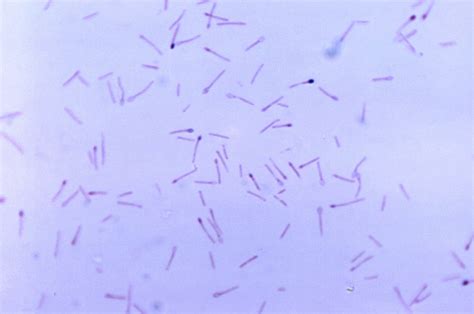 Clostridium Perfringens Microscope