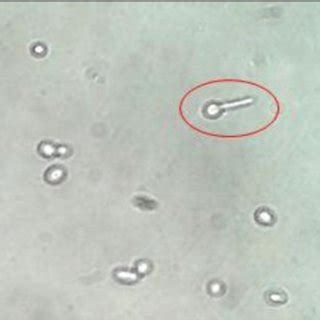 Candida In Stool