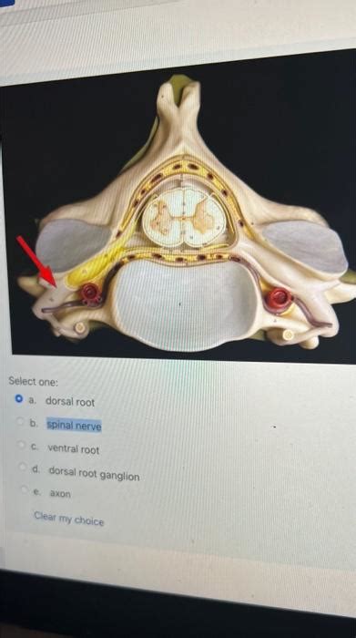 a. dorsal root b. spinal nerve c. ventral root d. | Chegg.com